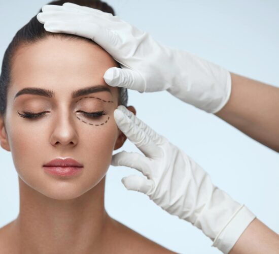 Blepharoplasty